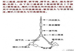 膀胱冲洗操作视频,步骤与技巧全解析
